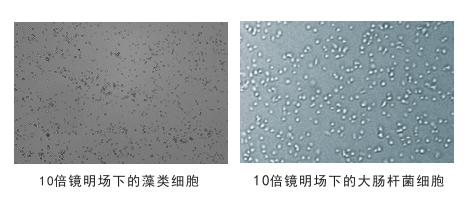 細胞計數(shù)儀鏡頭下的細胞圖片 細胞計數(shù)儀鏡頭下的細胞圖片